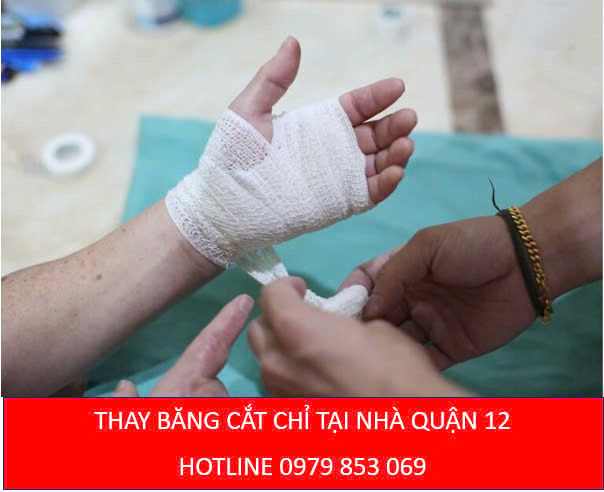 Thay băng cắt chỉ tại nhà Quận 12