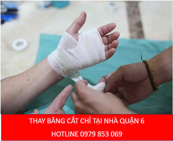 Thay băng cắt chỉ tại nhà Quận 6